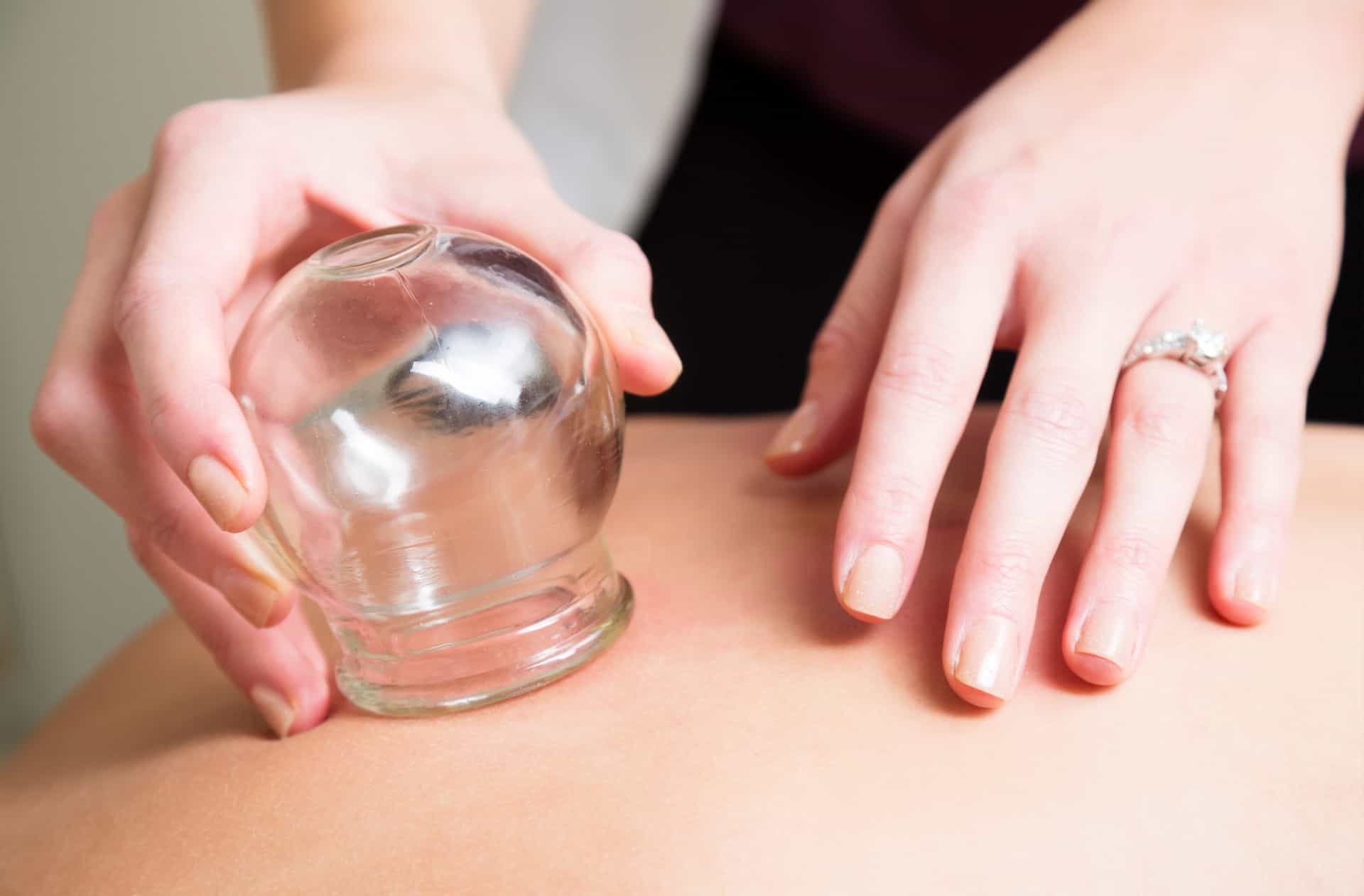 Person Receiving Cupping Therapy